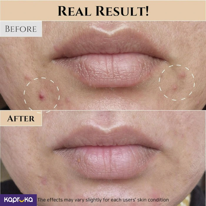 Skin Care ef_pc_cosm0v4472p00068 in Sri Lanka